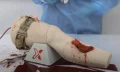 trauma-leg-5.webp