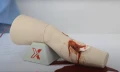 trauma-leg-444.webp