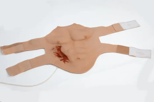Shrapnel-wound.webp